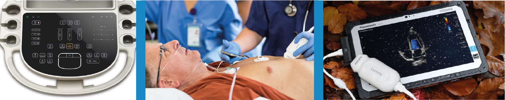 SISTEMAS DE ECOGRAFIA PARA EL PUNTO DE CUIDADO Y ACCESO REMOTO-01